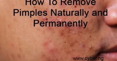 How To Remove Pimples Naturally and Permanently